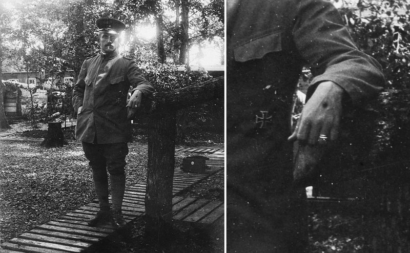 Soldat mit Handdurchschuss, wohl nach 1914